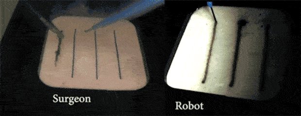 Робот сделал более точные разрезы с меньшим повреждением тканей
