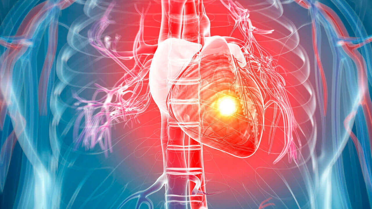 ИИ предсказывает сердечные приступы
