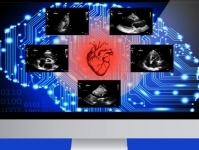 Технологии в кардиологии